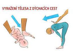 Cizí těleso v dýchacích cestách